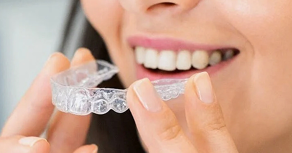 5 Things Parents Need to Know About Invisalign in San Francisco