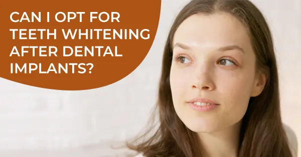 Can I Opt for Teeth Whitening After a Dental Implants? Can I Opt for Teeth Whitening After a Dental Implants?