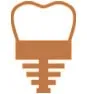 Dental Implants Dental Implants